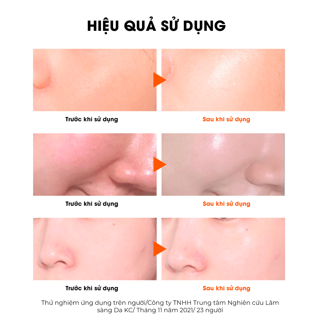 Mặt Nạ Sur.Medic+ Cung Cấp Multi Vitamin 30g | Hasaki.vn